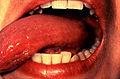 (Figure 9) With the aid of mouth mirrors, inspect the right and left lateral margins of the tongue.