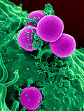 Thumbnail for Methicillin-resistant Staphylococcus aureus