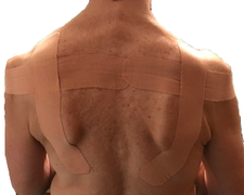 Kinesiology tape applied across the scapulas.