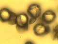 Photomicrograph of pollen grains.