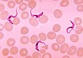 The protist Trypanosoma (the organism responsible for sleeping sickness, studied by Griffon du Bellay) in a human blood smear.