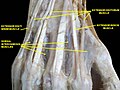 Muscles of hand. Posterior view.