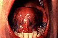 (Figure 11) Then examine the ventral surface. Palpate the tongue to detect growths.