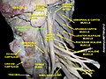 Longus capitis muscle