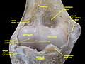 Elbow joint - deep dissection (anterior view, human cadaver)