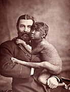William Leonard Hunt and Krao in 1883