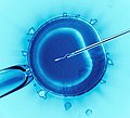 Thumbnail for In vitro fertilisation