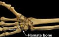 Right hand anterior view (palmar view). Thumb on top.
