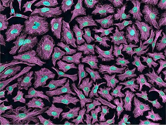 Multiphoton fluorescence image of HeLa cells with cytoskeletal microtubules (magenta) and DNA (cyan). Nikon RTS2000MP custom laser scanning microscope.