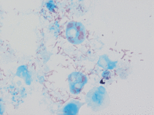 "Rickettsia conorii" observed in Vero cells (red rods; magnification ×1,000)