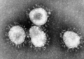 SARS Virus