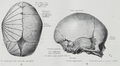 Skull showing parietal eminence as Tuber parietale