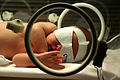 newborn daughter undergoing phototherapy to treat neonatal jaundice