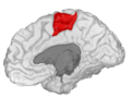 Paracentral lobule, shown in the right cerebral hemisphere.