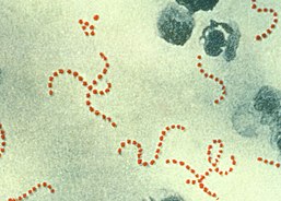 900x magnification of Streptococcus aureus