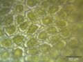 Higher magnification of the leaf surface, showing the trigones–cell wall thickenings in the corners between neighboring cells.
