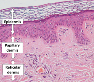 Epidermis, papillary dermis and reticular dermis.