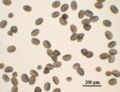 The pollen of the plant; objects like gray-brown oval seeds, seen under a microscope. A scale line says "200 micrometers"