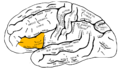 Lateral surface of left cerebral hemisphere, viewed from the side. (shown in orange).